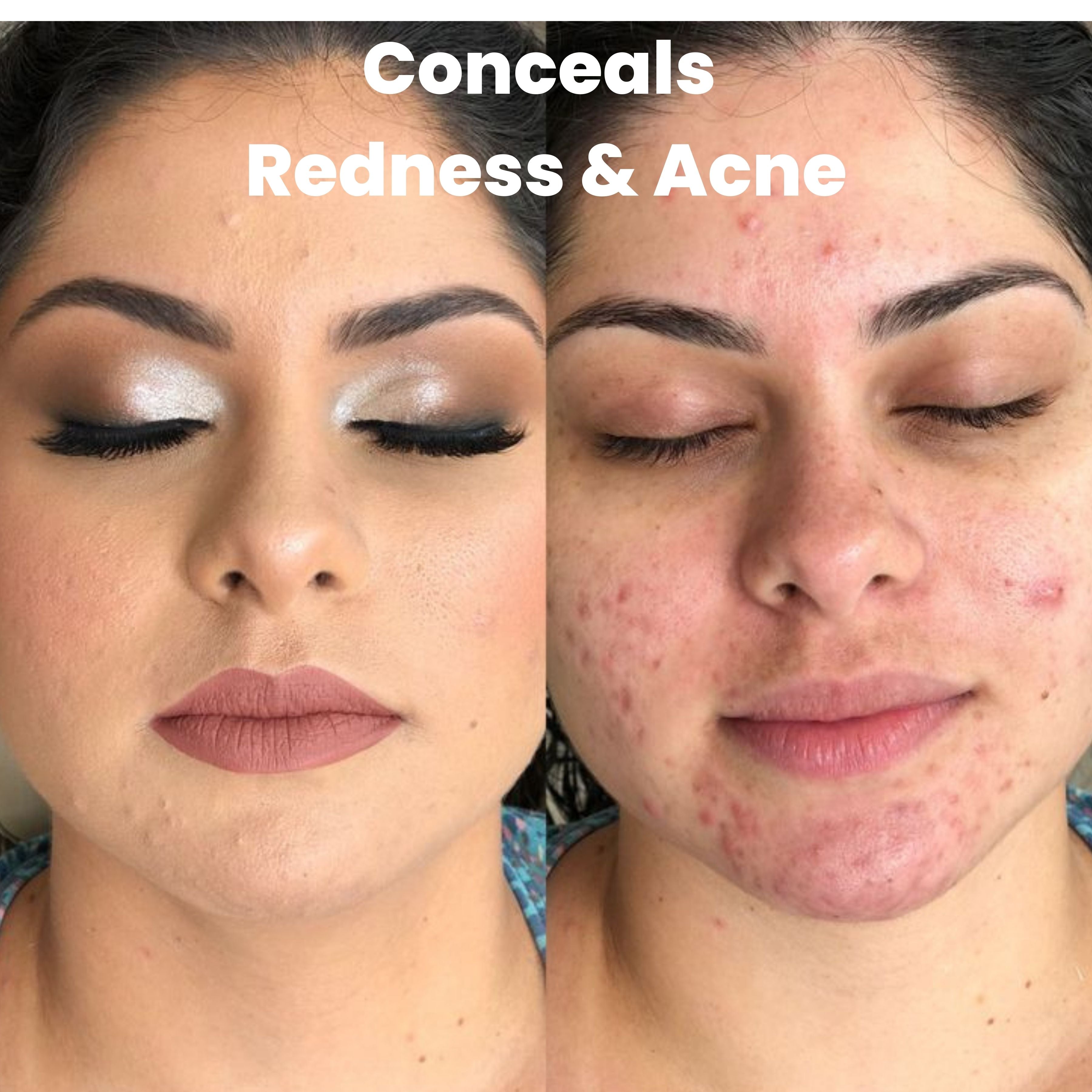 Relexa™ Skincare Cover Stick