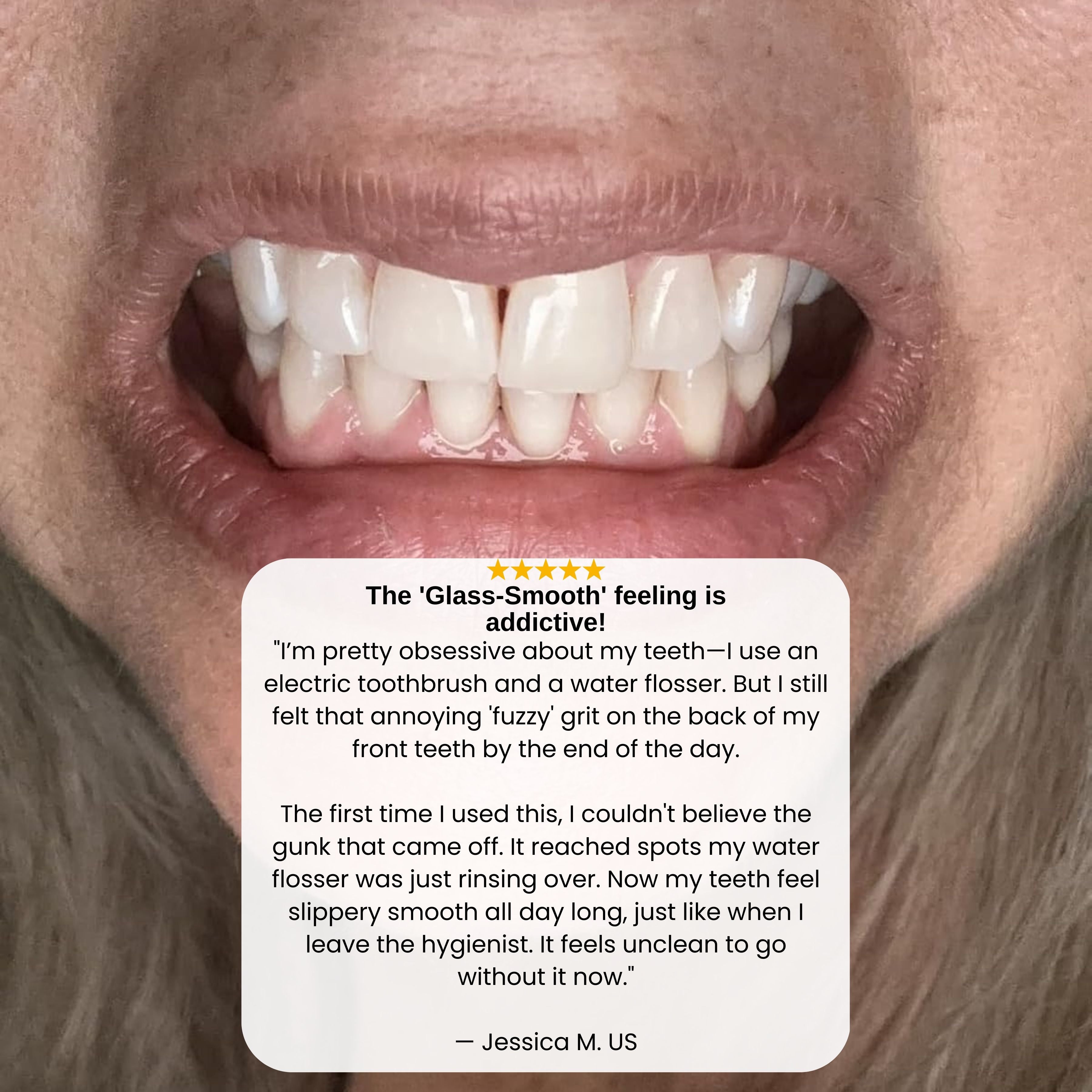 Relexa™ Tartar & Plaque Remover