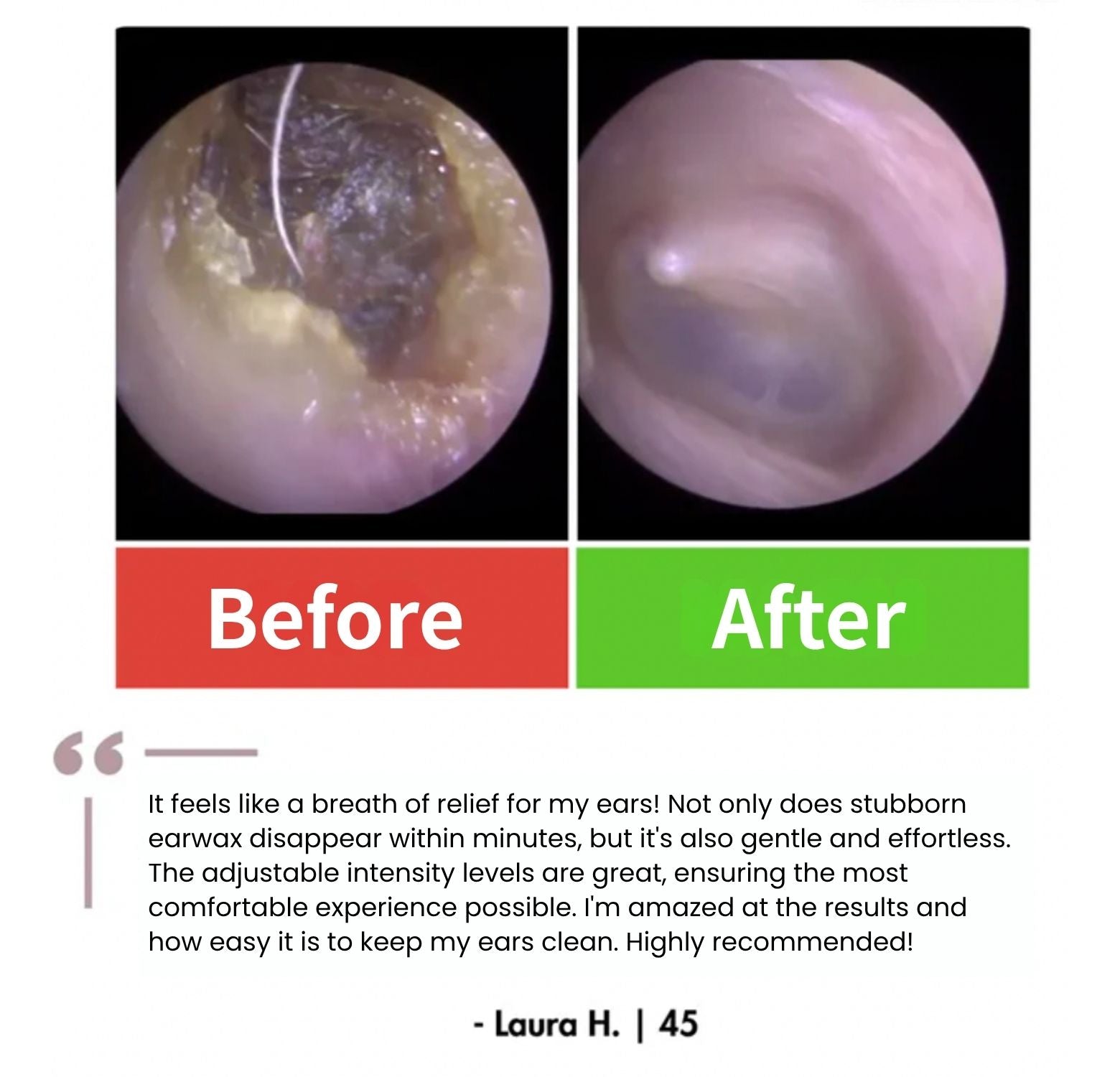 EchoGlow™ - Smart Care For Your Ears