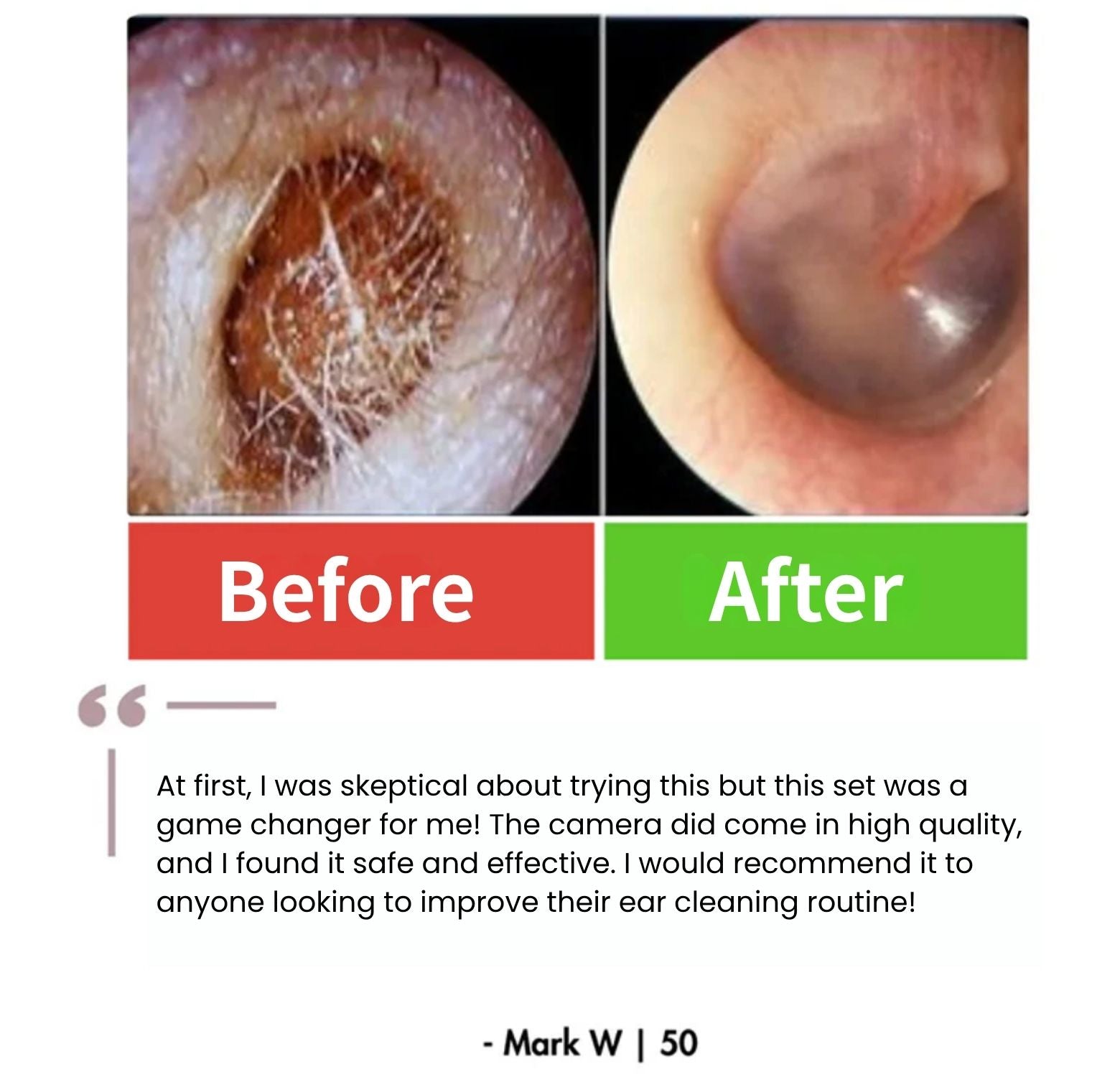 EchoGlow™ - Smart Care For Your Ears