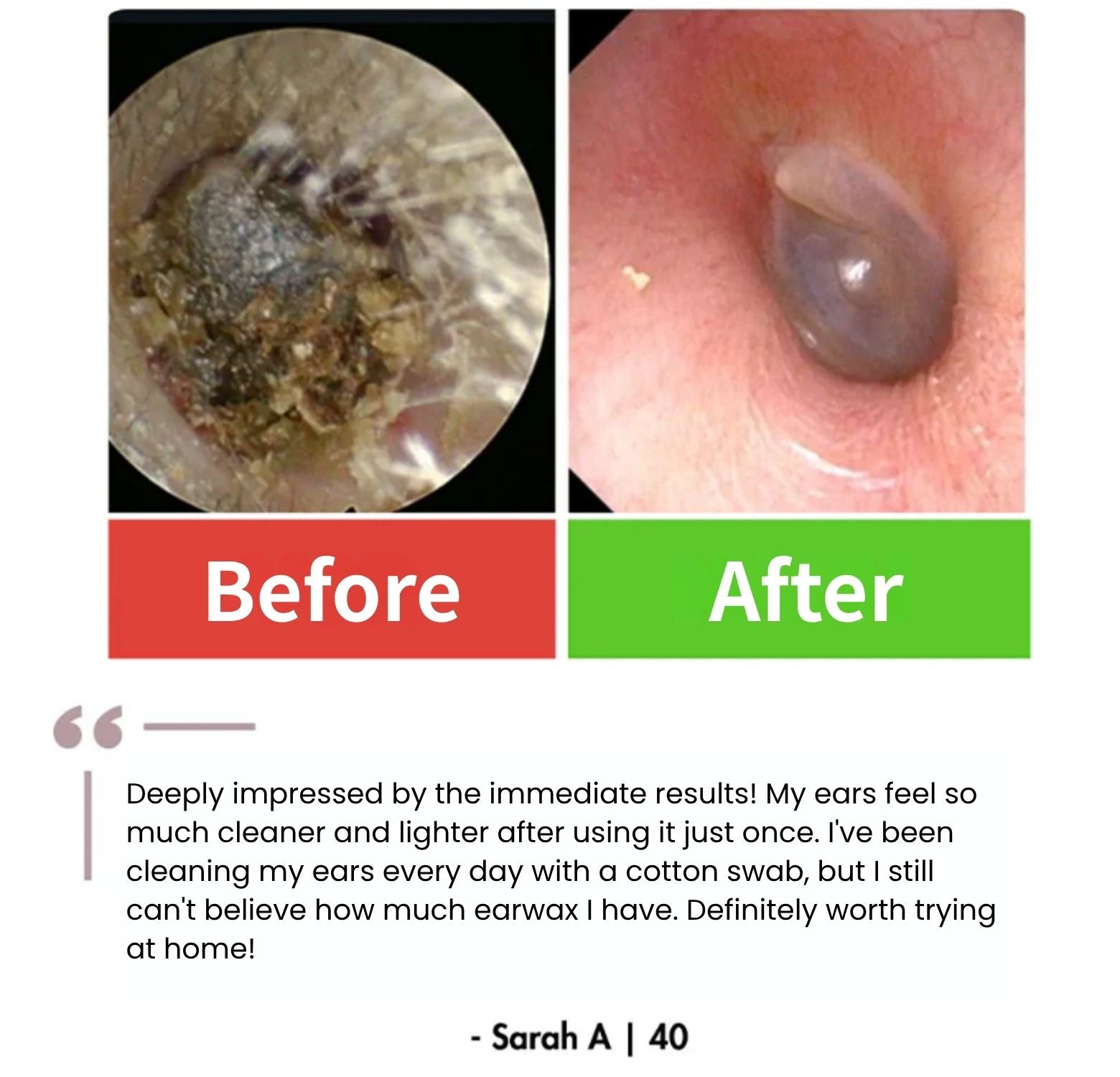 EchoGlow™ - Smart Care For Your Ears