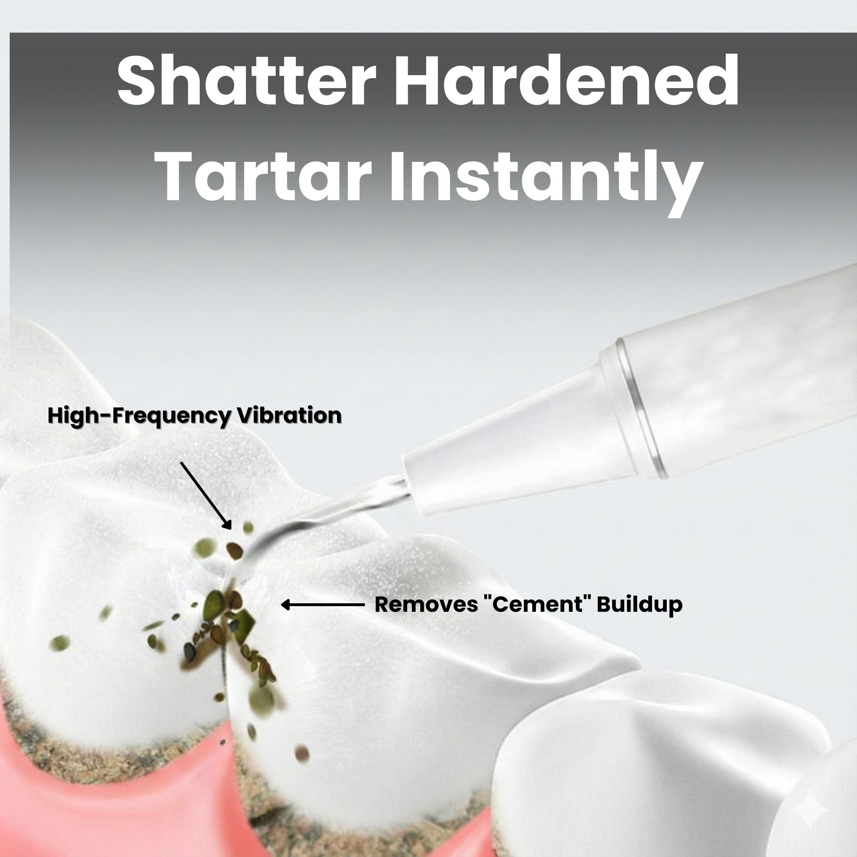 Relexa™ Tartar & Plaque Remover