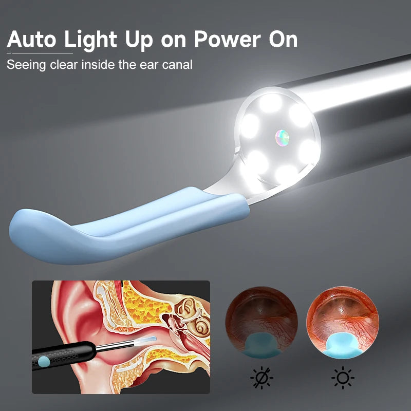 EchoGlow™ - Smart Care For Your Ears